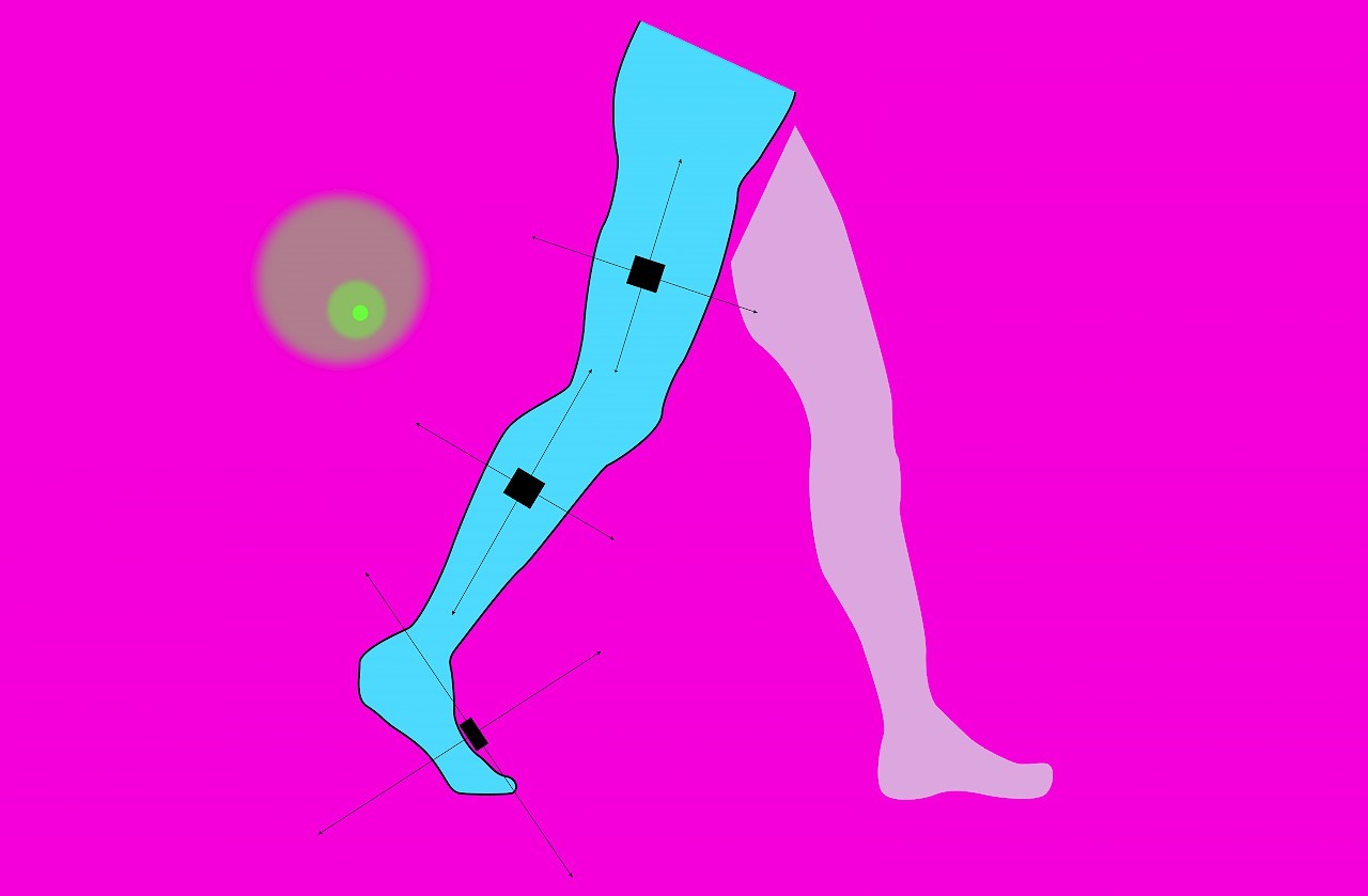 Evaluation of Feedback-Systems in automated Gait Training